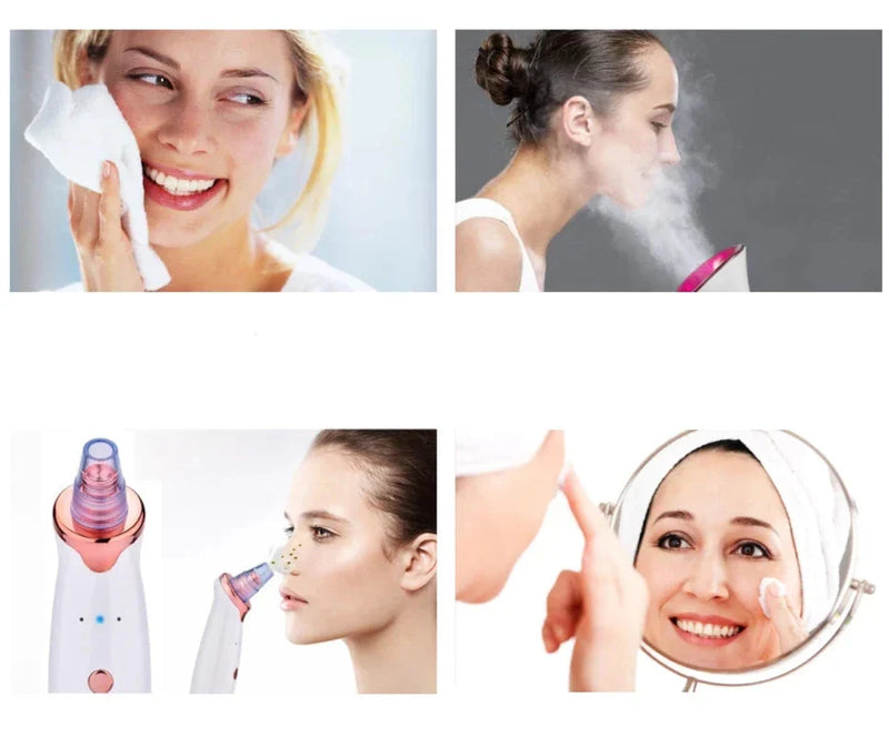 Removedor de puntos negros CleanPro (succión al vacío)